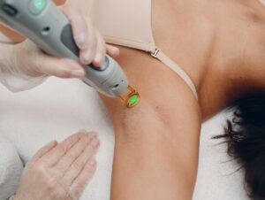 HAIR REMOVAL LASER 25